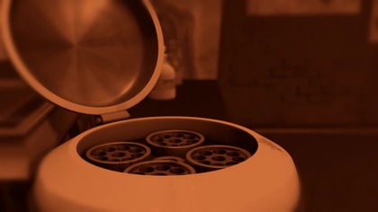 Teenage.  Mutant.  Ninja.  Turtles.  2012.  S01E23.  Użądleni