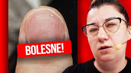 BRAK DOBREGO OŚWIETLENIA  WYPADEK! | KU PRZESTRODZE