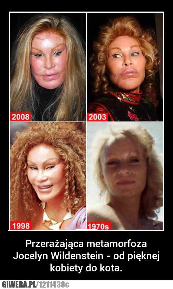 tragedia,operacje,plastyka,potwór,celebryta,obrzydzenie,twarz,zombie,