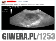 Podziękowania dla Durex Polska