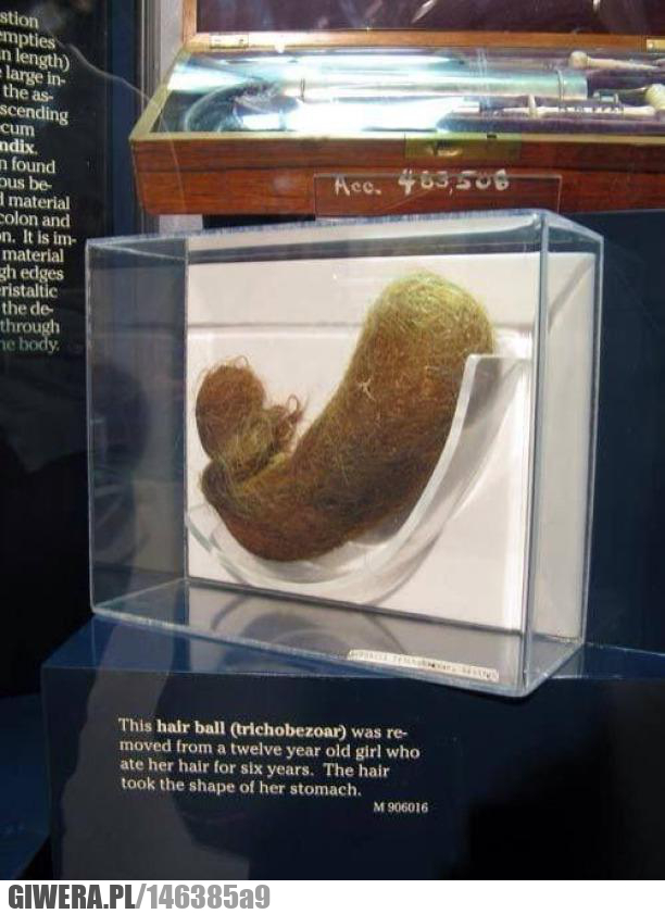 Włosy,choroba,operacja