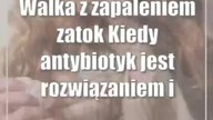 Walka z zapaleniem zatok: Kiedy antybiotyk jest rozwiązaniem i jak go właściwie wybrać