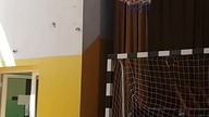 Ręka jak złamana #shorts