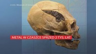 Wydłużona czaszka z metalową płytką sprzed 2 tys lat Niezwykłe odkrycie z Peru.