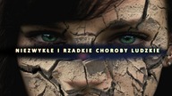 BODY BIZARRE, CZYLI NIEZWYKŁE I RZADKIE CHOROBY LUDZKIE