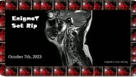 UDM - Illumination (Tom Exo Remix) (Cut From Phalanx Set)-enTc