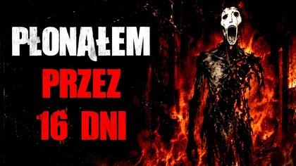 Płonąłem przez 16 dni...