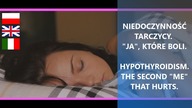 Niedoczynność tarczycy.  Drugie ja, które boli.  | Hypothyroidism.  Second me that hurts.