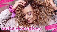 SUCHA SKÓRY GŁOWY  JAK NAWILŻYĆ? PRZYCZYNY | Curly Madeleine