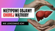 Tych 6 nietypowych objawów  Wątroba pełna TOKSYN! Sprawdź koniecznie!