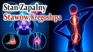 Stan Zapalny Stawów Biodrowych i Kręgosłupa, Bez Tabletek i Aptek, Przewlekłe Choroby.