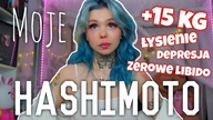 Jak żyję z HASHIMOTO?Moja Historia