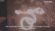 Cz2 / 3 - Brain Jabbed - Uszkodzony m&oacute;zg ( pokazujący co znaleziono w szczepionkach i do czeg