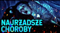 10 NAJRZADSZYCH CHOROB