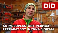 000.  Rak migdałka - Antyneoplastony, Płynna biopsja, Preparat SOT, Vermox