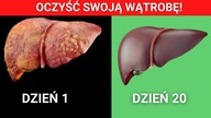 Domowe sposoby na odtrucie wątroby  Zrób domowy detoks wątroby I oczyść organizm