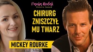 Aktor nie przypomina siebie! Popełniłem błąd.  Co się stało z jego twarzą? - Mickey Rourke