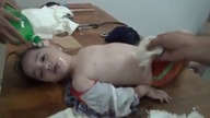 Ofiary Ataku chemicznego w Syrii