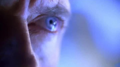 House M.  D.  S04E15 Houses Head