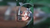 LiveLeak - Doctors remove a leech out of a boys throat