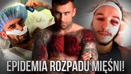 Dlaczego Zawodnikom Fame ROZPADAJĄ Się Mięśnie?