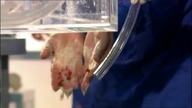 AUTOPSY - LIFE & DEAD | LESSON 3 - POISON | ENG |