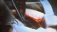 Oblicza śmierci / Faces of Death (1978) Lektor Dokument