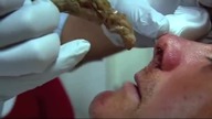Największe gile świata