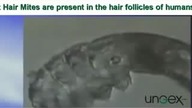 Demodex folliculorum (Nużeniec ludzki)
