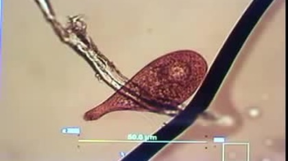 Rife-Bare Plasma Experiment Destroys Microorganisms