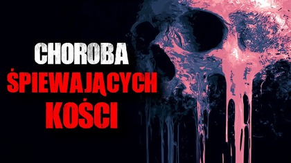 Choroba Śpiewających Kości - Straszna Historia