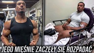 Jego Mięśnie Zaczęły Się ROZPADAĆ | Larry Wheels