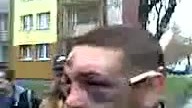 To musiało boleć
