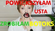 ZROBIŁAM USTA, WSTRZYKNĘŁAM BOTOKS ORAZ ULUBIEŃCY I ŚREDNIAKI LUTEGO.