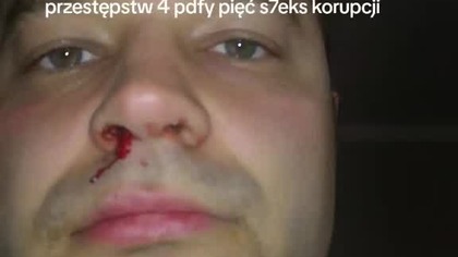 jak masz trójkę dzieci to jest po tobie nie możesz nic obronić się 3000 alimentów to 9000 faktura