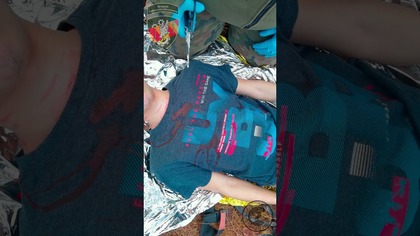  Opatrunek okluzyjny Chest Seal Rhino Rescue | Sprzęt medycyny taktycznej  przegląd #ChestSeal