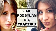 JAK POZBYĆ SIĘ TRĄDZIKU | Jak zwalczyłam trądzik