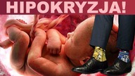 HIPOKRYZJA polityków! Zakładają kolorowe skarpetki, chcąc zabijania dzieci z Zespołem Downa