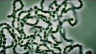 Sytuacja w Fukushime