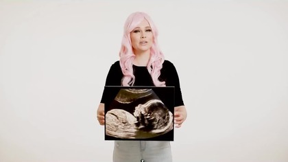 Aborcja- mordestwo niewinnych dzieci z troski (ironia).Kto ma żyć kto nie, kto ma mieć prawo do życia kto nie?Po dzieciach kto(z troski)?