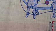 Reverse Windmill Dunk #shorts