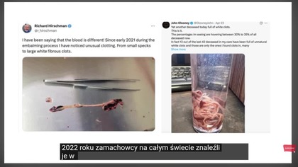 Gumowe skrzepy po kowidziance i jak sie ich pozbywac i czym sa