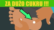 8 Znaków Jakie Daje Ci Organizm Gdy Jesz Za Dużo Cukru