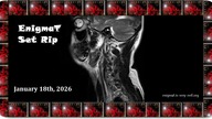 Losless - OOMM (Cut From Ferry Set)-enTc
