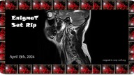 Matchy - Be There (Cut From Matchy Set)-enTc