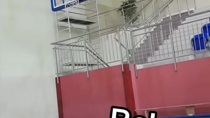 Ręka do amputacji #shorts #fail