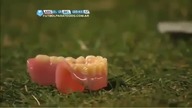 Szczęka na boisku