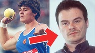 7 Kobiet Przed i Po Stosowaniu Sterydów