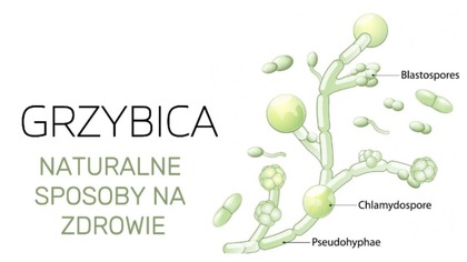 Naturalne Sposoby na Grzybicę Które Musisz Znać