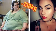 Kobieta w wieku 24 lat ważyła 300kg teraz wygląda jak gwiazda